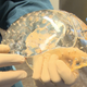 Illustration for article titled Take a Look at the First Successfully Transplanted, 3D-Printed Skull